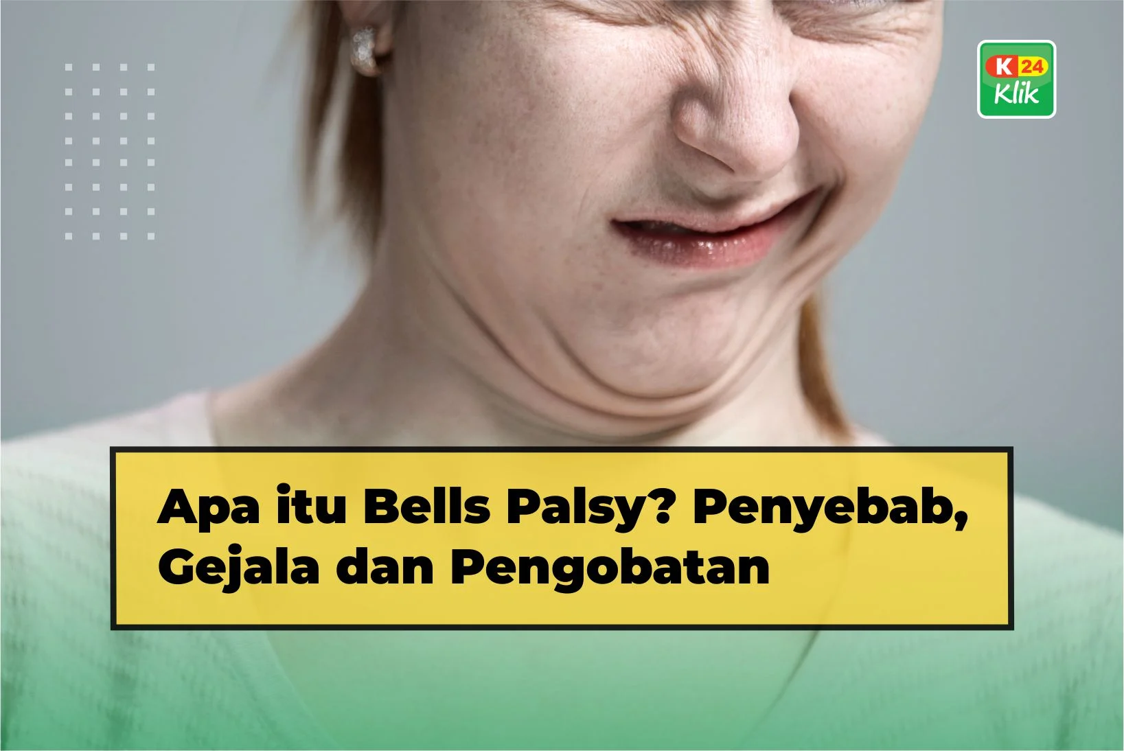 apa itu bells palsy