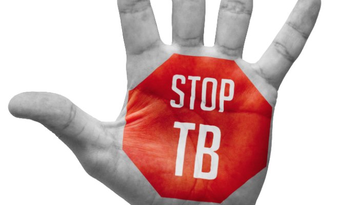TBC