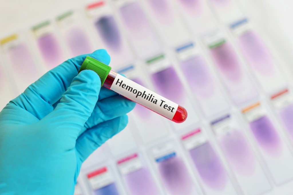 hemopilia test hijau
