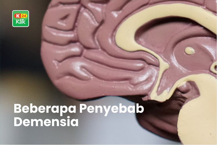 penyebab-demensia