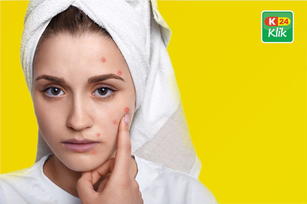 efek samping skincare