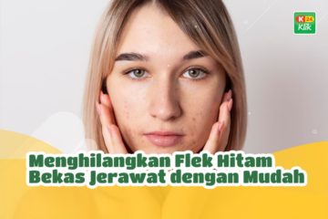 k24klik-cara-menghilangkan-flek-hitam-bekas-jerawat
