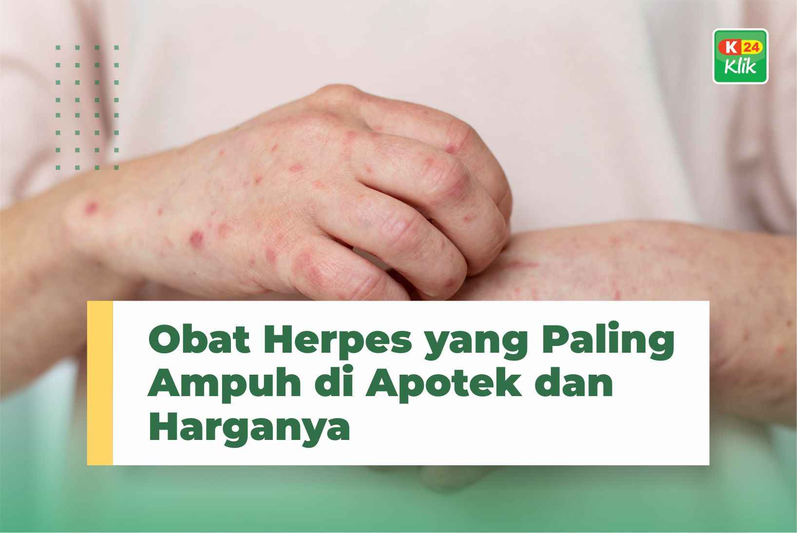 Obat Herpes yang Paling Ampuh di Apotek dan Harganya