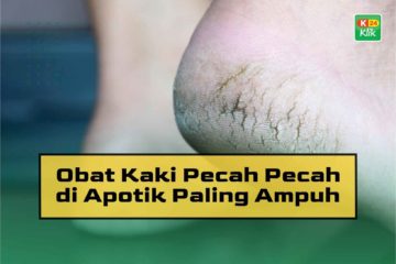 Obat Kaki Pecah Pecah di Apotik Paling Ampuh