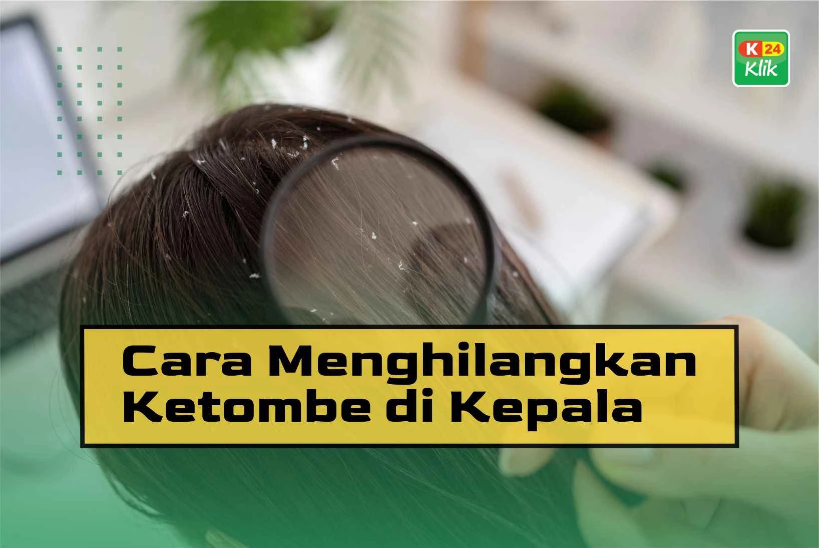 cara menghilangkan ketombe di kepala