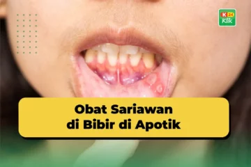 Obat Sariawan di Bibir di Apotik