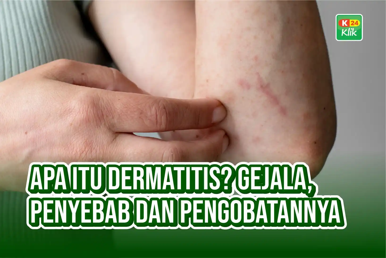 apa itu dermatitis