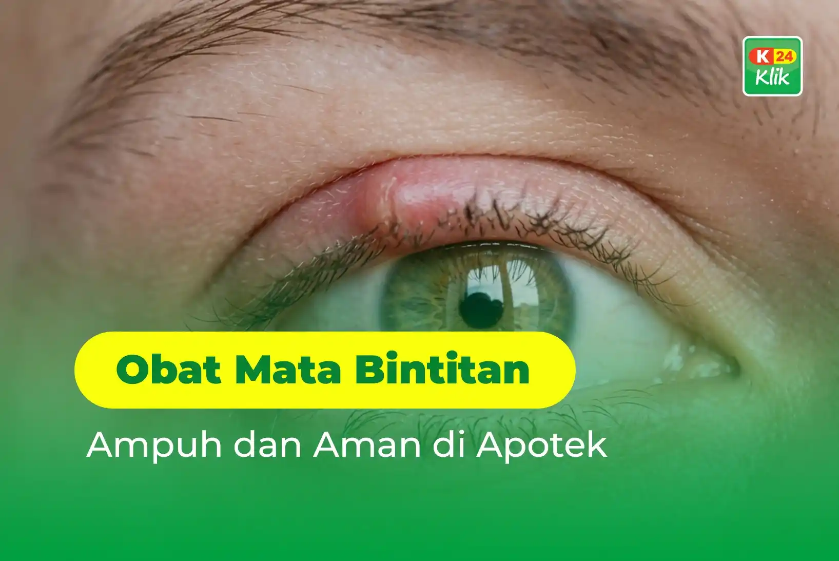obat mata bintitan
