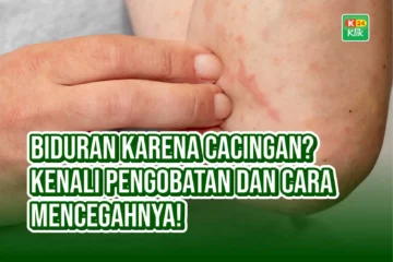 biduran karena cacingan